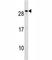 NK2 Homeobox 8 antibody, F46147-0.4ML, NSJ Bioreagents, Western Blot image 