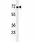 Non-receptor tyrosine-protein kinase TNK1 antibody, F40236-0.4ML, NSJ Bioreagents, Western Blot image 