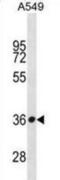 Serine Protease 57 antibody, abx031264, Abbexa, Western Blot image 