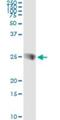 Synaptosome Associated Protein 23 antibody, H00008773-M01, Novus Biologicals, Immunoprecipitation image 