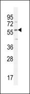 FAM20C Golgi Associated Secretory Pathway Kinase antibody, LS-B12964, Lifespan Biosciences, Western Blot image 