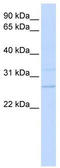 Transmembrane Protein 126B antibody, TA331045, Origene, Western Blot image 