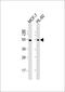 Lipoprotein Lipase antibody, A00316-1, Boster Biological Technology, Western Blot image 