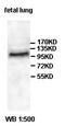 Hexokinase 2 antibody, orb77677, Biorbyt, Immunohistochemistry paraffin image 