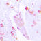 Carbonic Anhydrase 1 antibody, LS-C351898, Lifespan Biosciences, Immunohistochemistry paraffin image 