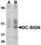 CD209 Molecule antibody, 18710, QED Bioscience, Western Blot image 