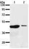Arylacetamide Deacetylase Like 4 antibody, PA5-49736, Invitrogen Antibodies, Western Blot image 