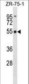 F-Box Protein 5 antibody, LS-C166090, Lifespan Biosciences, Western Blot image 