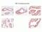 Kallikrein Related Peptidase 2 antibody, MA1-5809, Invitrogen Antibodies, Immunohistochemistry paraffin image 