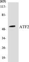 Cyclic AMP-dependent transcription factor ATF-2 antibody, EKC1041, Boster Biological Technology, Western Blot image 