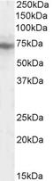 Intraflagellar Transport 74 antibody, 45-408, ProSci, Enzyme Linked Immunosorbent Assay image 