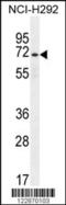 NUAK Family Kinase 2 antibody, 55-066, ProSci, Western Blot image 