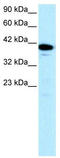 Nuclear Transcription Factor Y Subunit Alpha antibody, TA329254, Origene, Western Blot image 