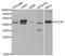 Egl-9 Family Hypoxia Inducible Factor 1 antibody, A1151, ABclonal Technology, Western Blot image 