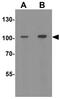 Hexokinase 1 antibody, GTX31625, GeneTex, Western Blot image 