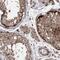 TCDD-inducible poly [ADP-ribose] polymerase antibody, HPA036796, Atlas Antibodies, Immunohistochemistry frozen image 