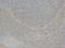 Checkpoint Kinase 2 antibody, LS-C171940, Lifespan Biosciences, Immunohistochemistry paraffin image 
