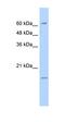 Solute Carrier Family 13 Member 3 antibody, orb330178, Biorbyt, Western Blot image 