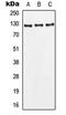 Leptin Receptor antibody, MBS821996, MyBioSource, Western Blot image 