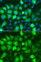 Ribonucleotide Reductase Regulatory Subunit M2 antibody, 19-553, ProSci, Immunofluorescence image 