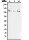TAO Kinase 3 antibody, LS-C353447, Lifespan Biosciences, Western Blot image 