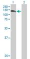 Ubiquitin Specific Peptidase 1 antibody, H00007398-B01P, Novus Biologicals, Western Blot image 