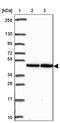 SELENON antibody, PA5-63520, Invitrogen Antibodies, Western Blot image 