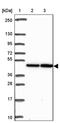 Selenoprotein N antibody, PA5-63520, Invitrogen Antibodies, Western Blot image 