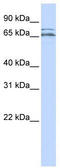 Calcium Voltage-Gated Channel Auxiliary Subunit Beta 2 antibody, TA338804, Origene, Western Blot image 