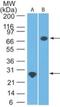 DEAD-Box Helicase 3 X-Linked antibody, NBP2-14848, Novus Biologicals, Western Blot image 