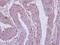 Dpy-19 Like 4 antibody, NBP2-16222, Novus Biologicals, Immunohistochemistry paraffin image 