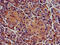 Sphingomyelin Synthase 1 antibody, CSB-PA801243LA01HU, Cusabio, Immunohistochemistry paraffin image 