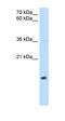 NADH:Ubiquinone Oxidoreductase Subunit B5 antibody, orb330408, Biorbyt, Western Blot image 