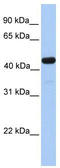 Galactose-3-O-sulfotransferase 3 antibody, TA339640, Origene, Western Blot image 