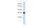 KIT Ligand antibody, 25-951, ProSci, Western Blot image 