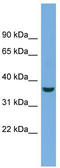 Crystallin Mu antibody, TA340029, Origene, Western Blot image 