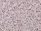 Transcription Factor 7 antibody, A01315-1, Boster Biological Technology, Immunohistochemistry paraffin image 