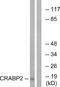 CRABP-II antibody, A30602, Boster Biological Technology, Western Blot image 