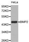 Guided Entry Of Tail-Anchored Proteins Factor 3, ATPase antibody, orb48287, Biorbyt, Western Blot image 