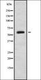 Interferon Induced Transmembrane Protein 2 antibody, orb337760, Biorbyt, Western Blot image 