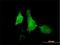 Arachidonate 12-Lipoxygenase, 12S Type antibody, H00000239-B01P, Novus Biologicals, Immunofluorescence image 