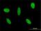 GLI Family Zinc Finger 3 antibody, H00002737-M01, Novus Biologicals, Immunocytochemistry image 
