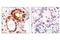 Erb-B2 Receptor Tyrosine Kinase 3 antibody, 4791L, Cell Signaling Technology, Immunohistochemistry paraffin image 