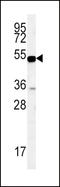 SLC9A3 Regulator 1 antibody, LS-C161280, Lifespan Biosciences, Western Blot image 