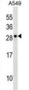 Cardiotrophin Like Cytokine Factor 1 antibody, abx030553, Abbexa, Western Blot image 