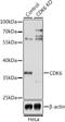 Cyclin Dependent Kinase 6 antibody, GTX55566, GeneTex, Western Blot image 