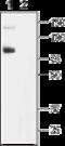 Transient Receptor Potential Cation Channel Subfamily C Member 6 antibody, GTX54757, GeneTex, Western Blot image 