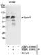 Clathrin Interactor 1 antibody, NBP1-05990, Novus Biologicals, Immunoprecipitation image 