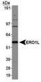 Endoplasmic Reticulum Oxidoreductase 1 Alpha antibody, TA309644, Origene, Western Blot image 