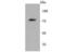 Protein Kinase C Beta antibody, NBP2-67062, Novus Biologicals, Western Blot image 